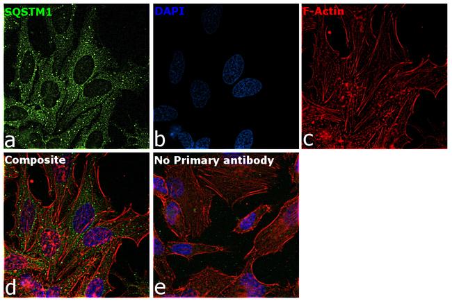 SQSTM1 Antibody in Immunocytochemistry (ICC/IF)