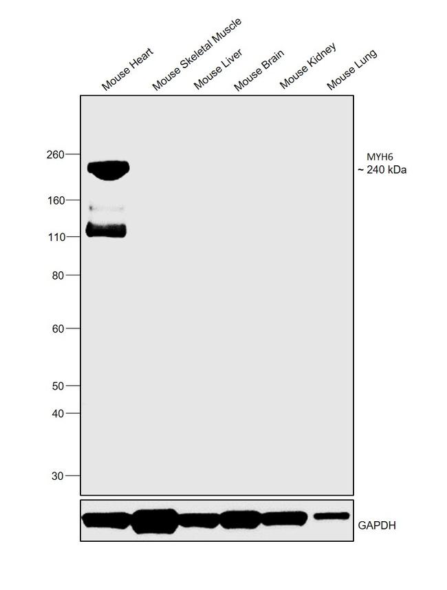 MYH6 Antibody in Western Blot (WB)