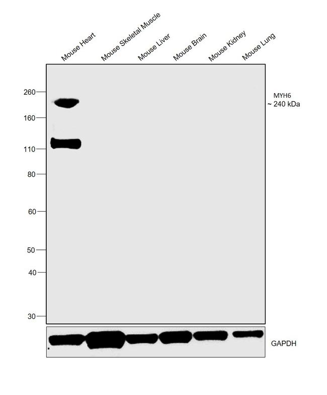 MYH6 Antibody in Western Blot (WB)