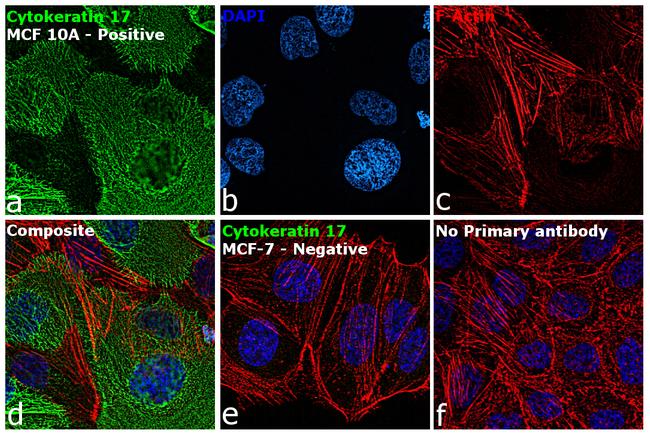 Cytokeratin 17 Antibody in Immunocytochemistry (ICC/IF)