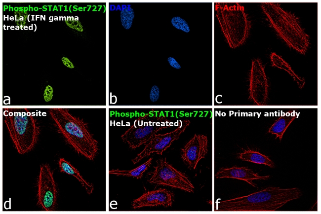 Phospho-Stat1 (Ser727) Antibody in Immunocytochemistry (ICC/IF)