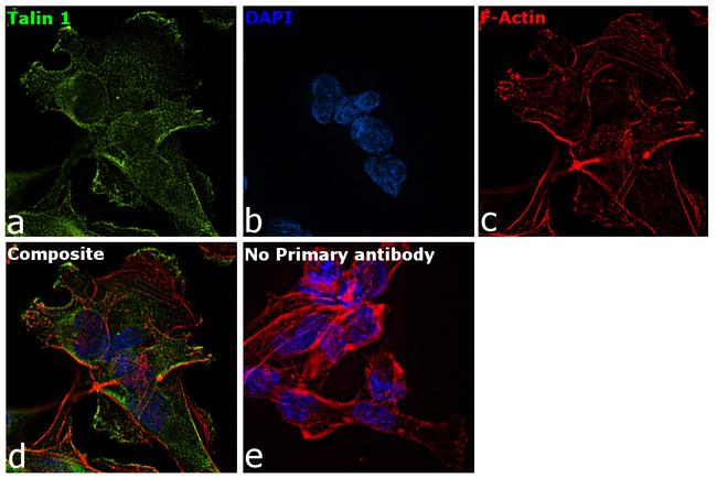 Talin Antibody in Immunocytochemistry (ICC/IF)