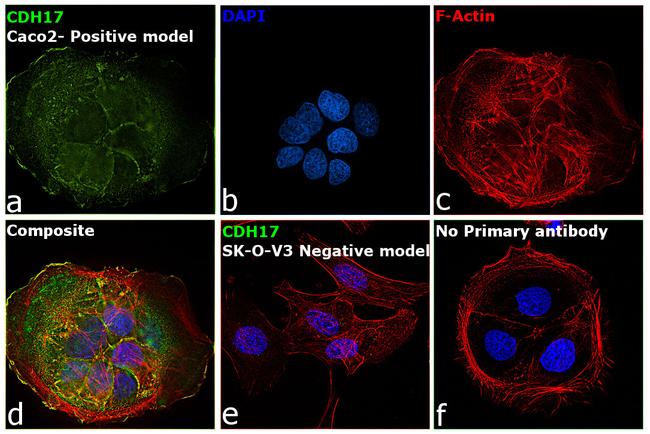 CDH17 Antibody in Immunocytochemistry (ICC/IF)