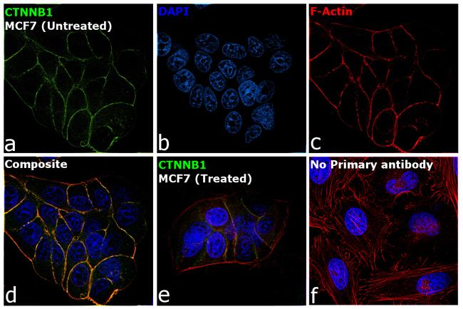 beta Catenin Antibody in Immunocytochemistry (ICC/IF)