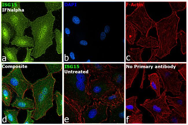 ISG15 Antibody in Immunocytochemistry (ICC/IF)