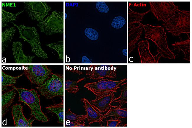 NME1 Antibody in Immunocytochemistry (ICC/IF)