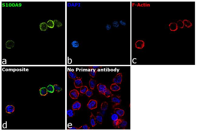 S100A9 Antibody in Immunocytochemistry (ICC/IF)