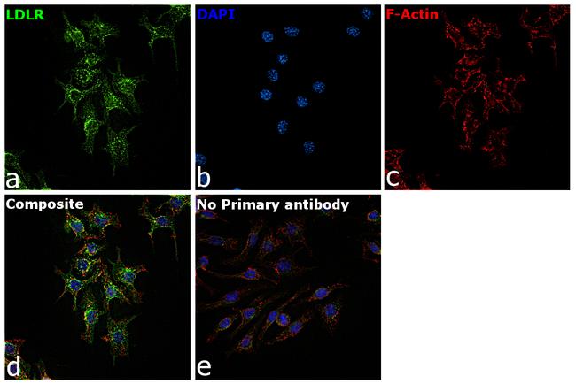 LDLR Antibody in Immunocytochemistry (ICC/IF)