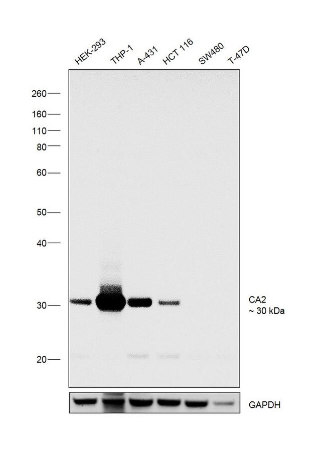 Carbonic Anhydrase II Antibody in Western Blot (WB)