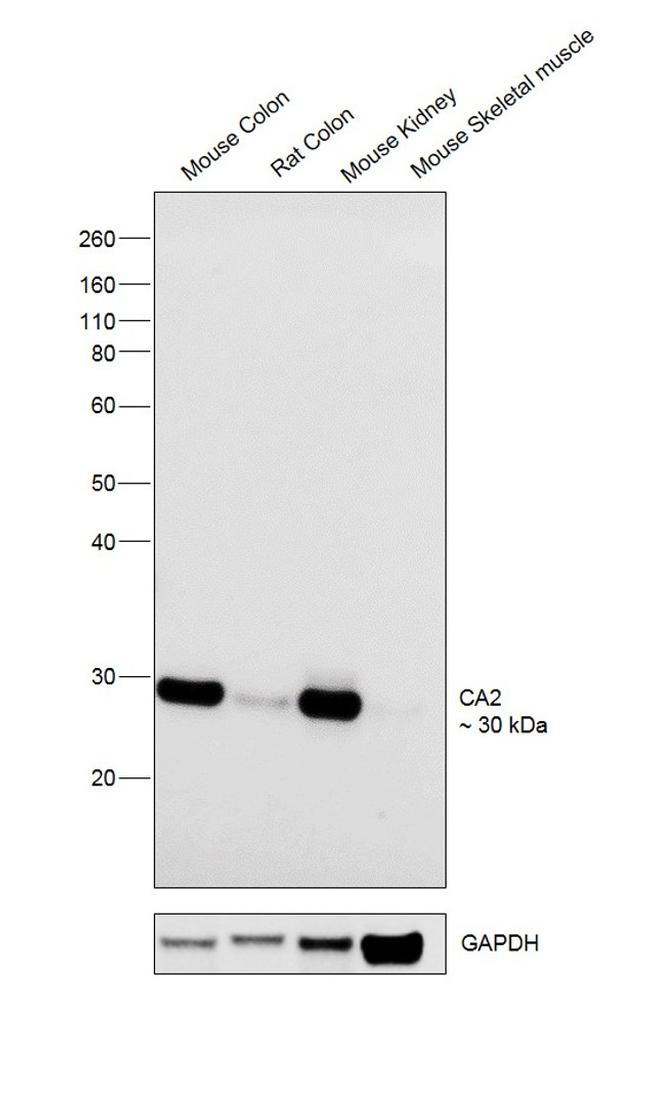 Carbonic Anhydrase II Antibody in Western Blot (WB)