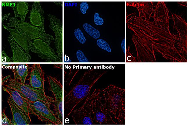 NME1 Antibody in Immunocytochemistry (ICC/IF)