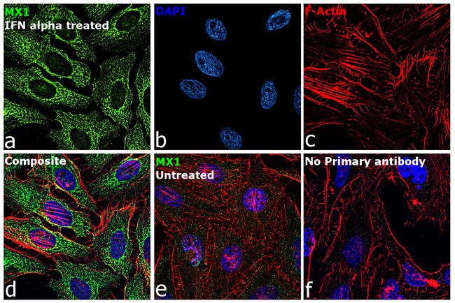 MX1 Antibody in Immunocytochemistry (ICC/IF)