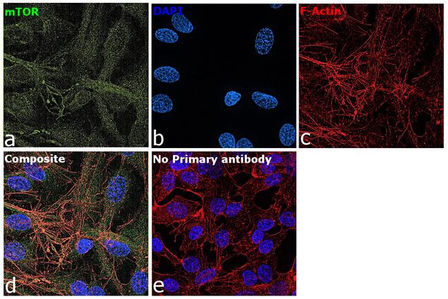 mTOR Antibody in Immunocytochemistry (ICC/IF)