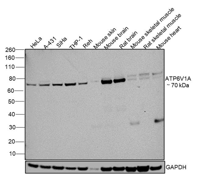 ATP6V1A Antibody in Western Blot (WB)