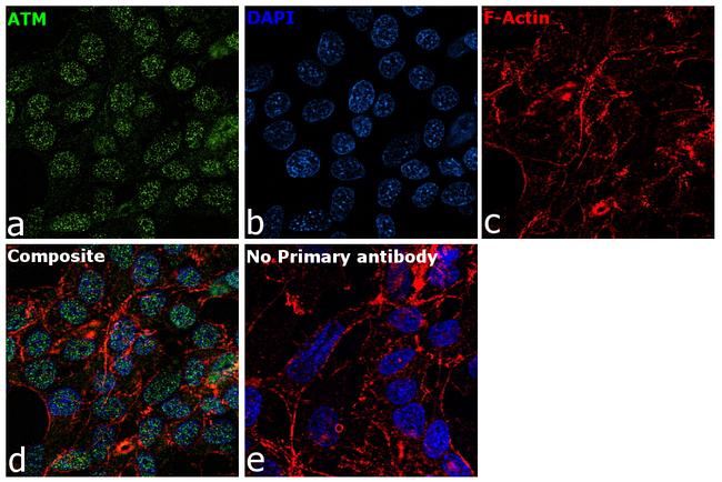 ATM Antibody in Immunocytochemistry (ICC/IF)