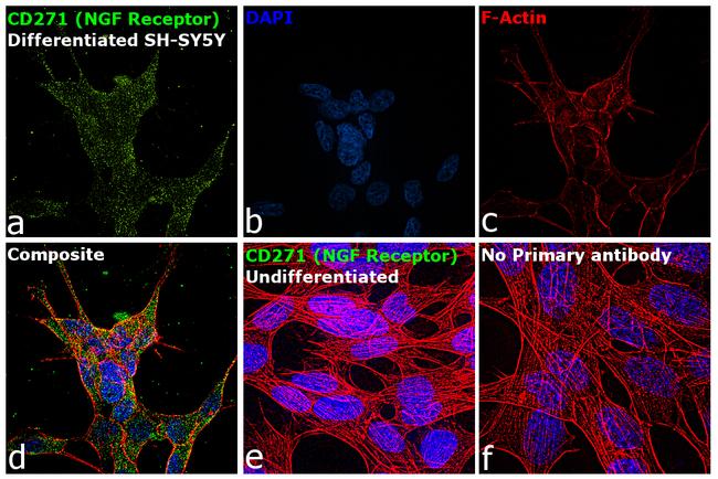 CD271 (NGF Receptor) Antibody in Immunocytochemistry (ICC/IF)