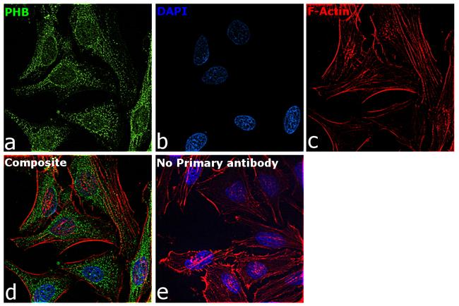 Prohibitin Antibody in Immunocytochemistry (ICC/IF)