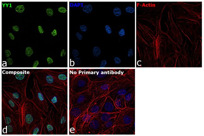 YY1 Antibody in Immunocytochemistry (ICC/IF)