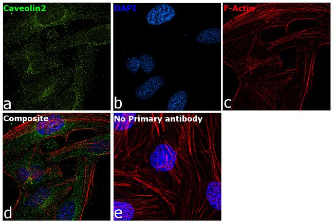 Caveolin 2 Antibody in Immunocytochemistry (ICC/IF)