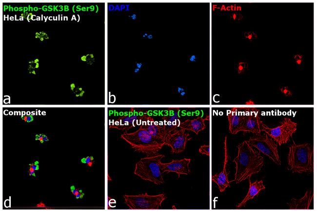 Phospho-GSK3B (Ser9) Antibody in Immunocytochemistry (ICC/IF)