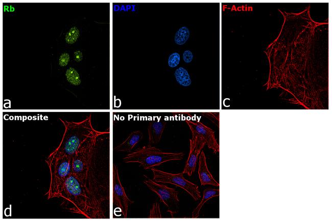 Rb Antibody in Immunocytochemistry (ICC/IF)