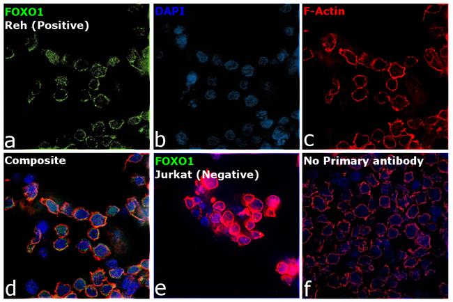 FOXO1 Antibody in Immunocytochemistry (ICC/IF)