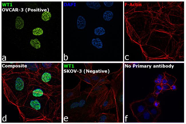 WT1 Antibody in Immunocytochemistry (ICC/IF)