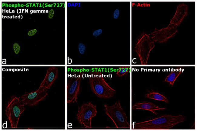 Phospho-STAT1 (Ser727) Antibody in Immunocytochemistry (ICC/IF)