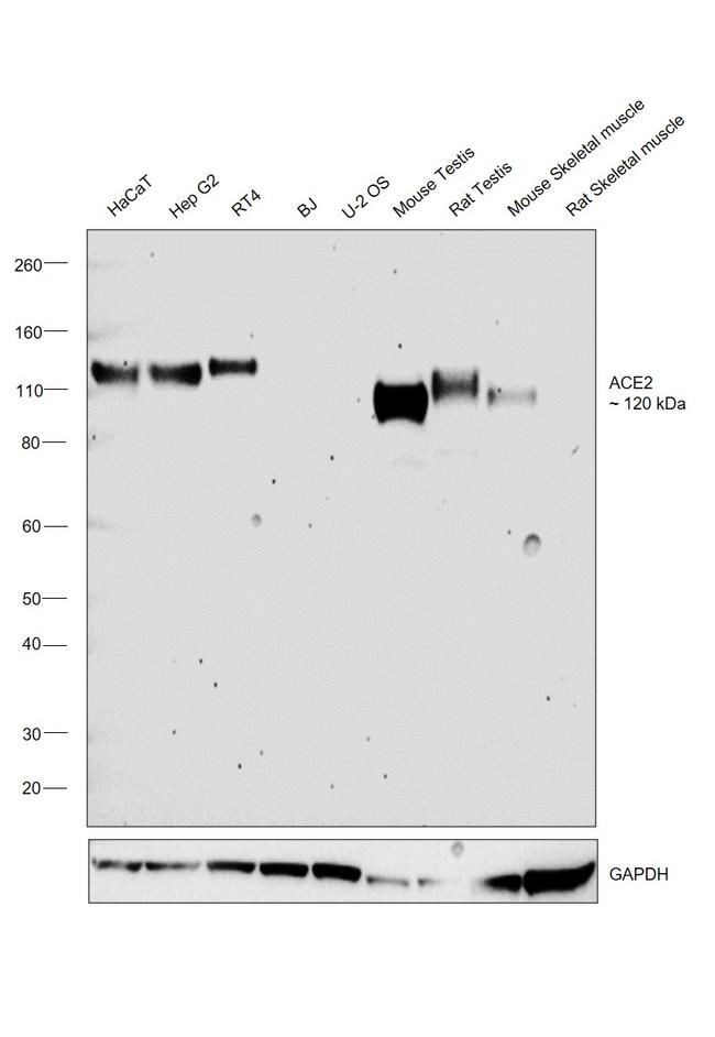 ACE2 Antibody in Western Blot (WB)