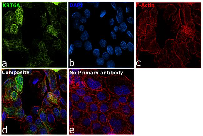 Cytokeratin 6 Antibody in Immunocytochemistry (ICC/IF)