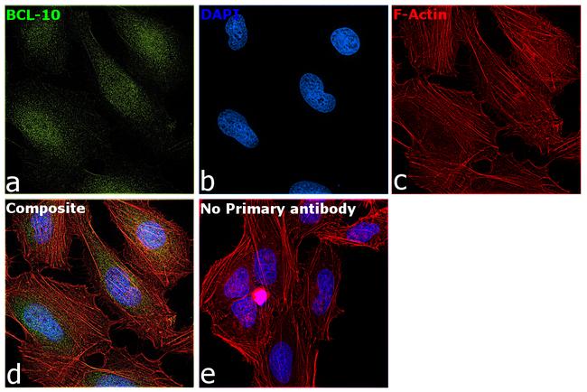 Bcl-10 Antibody in Immunocytochemistry (ICC/IF)