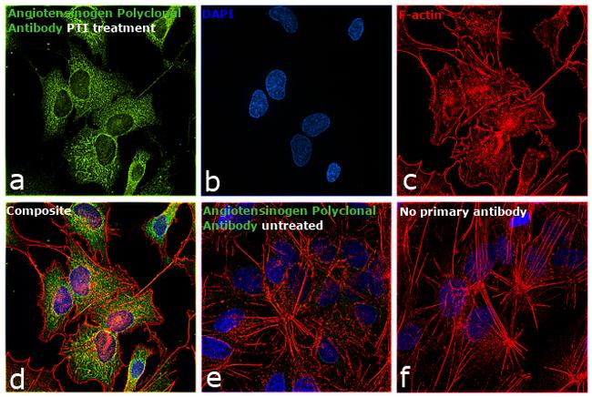 Angiotensinogen Antibody in Immunocytochemistry (ICC/IF)