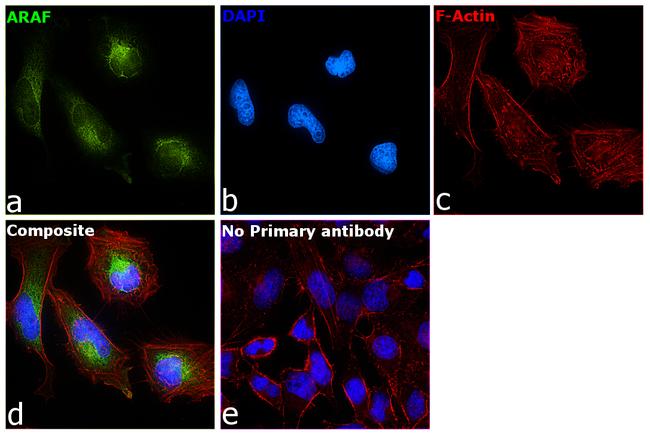 A-Raf Antibody in Immunocytochemistry (ICC/IF)