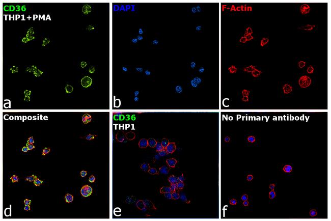 CD36 Antibody in Immunocytochemistry (ICC/IF)