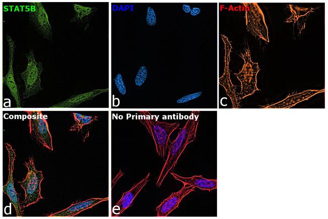 STAT5 alpha/beta Antibody in Immunocytochemistry (ICC/IF)