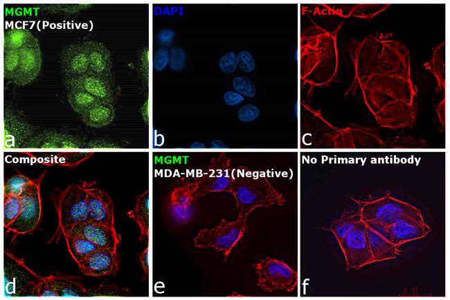 MGMT Antibody in Immunocytochemistry (ICC/IF)