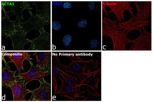 Actin Antibody in Immunocytochemistry (ICC/IF)