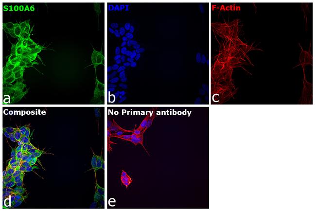 S100A6 Antibody in Immunocytochemistry (ICC/IF)