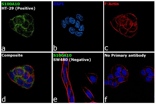 S100A10 Antibody in Immunocytochemistry (ICC/IF)