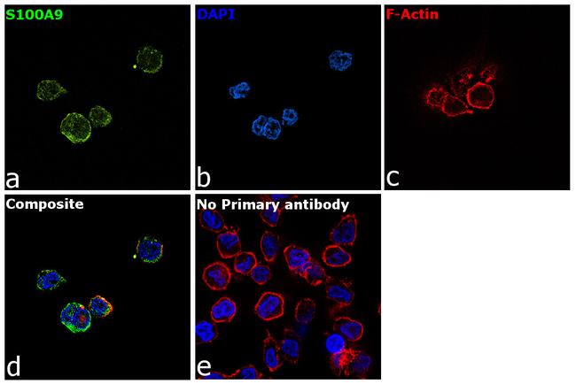 S100A9 Antibody in Immunocytochemistry (ICC/IF)