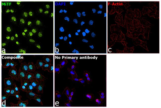 MiTF Antibody in Immunocytochemistry (ICC/IF)