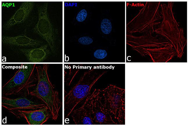 Aquaporin 1 Antibody in Immunocytochemistry (ICC/IF)