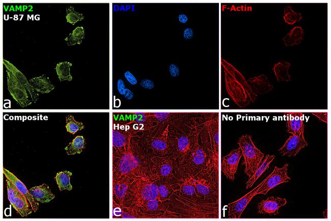 VAMP2 Antibody in Immunocytochemistry (ICC/IF)