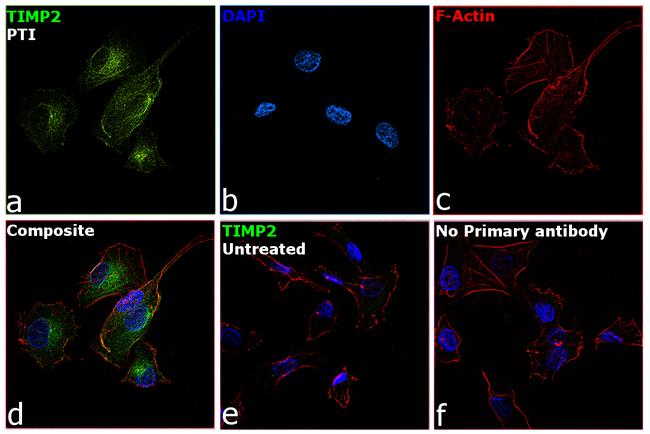 TIMP2 Antibody in Immunocytochemistry (ICC/IF)