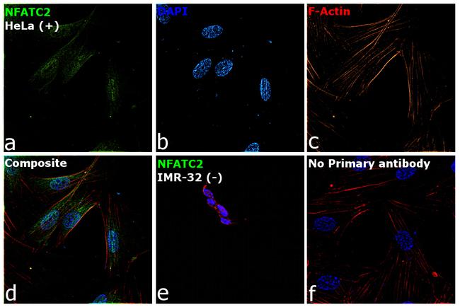 NFATC2 Antibody in Immunocytochemistry (ICC/IF)