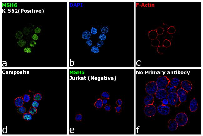 MSH6 Antibody in Immunocytochemistry (ICC/IF)