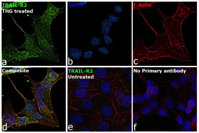 TRAIL-R2 (DR5) Antibody in Immunocytochemistry (ICC/IF)