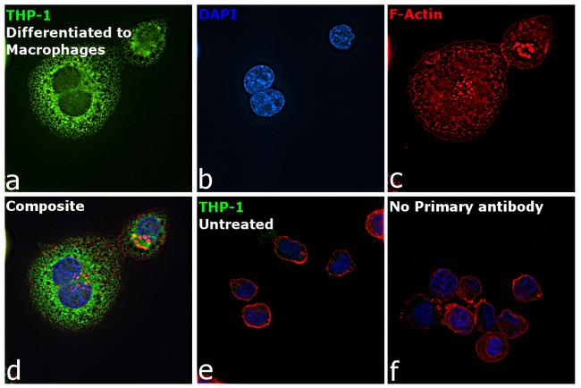 MMP9 Antibody in Immunocytochemistry (ICC/IF)