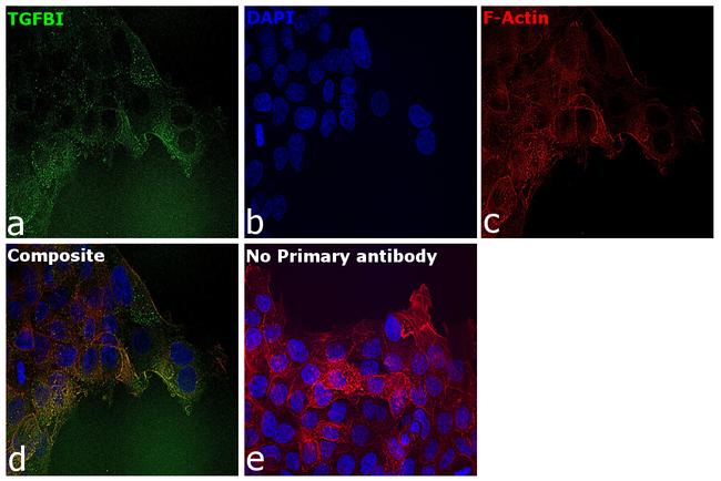 TGFBI Antibody in Immunocytochemistry (ICC/IF)