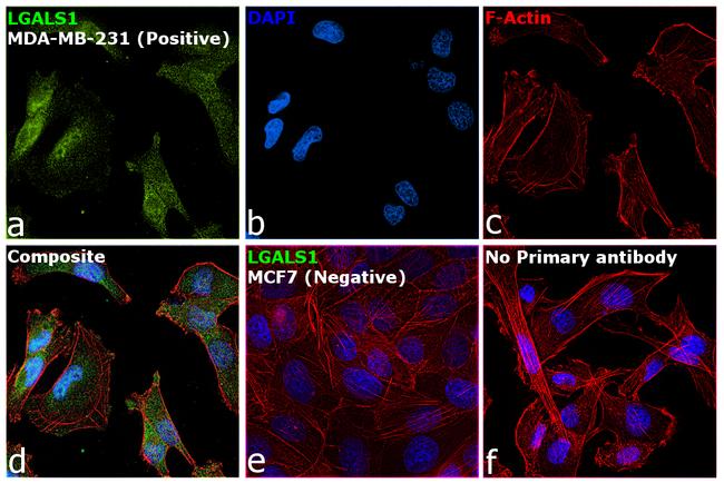 Galectin 1 Antibody in Immunocytochemistry (ICC/IF)